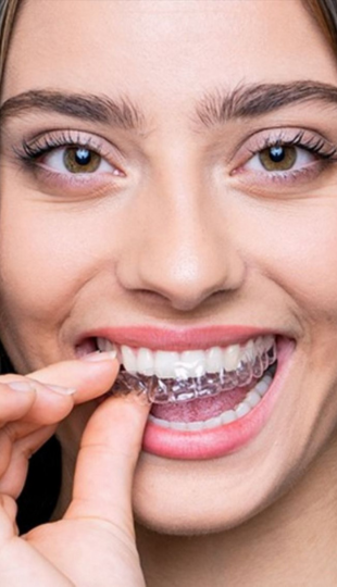 Invisalign